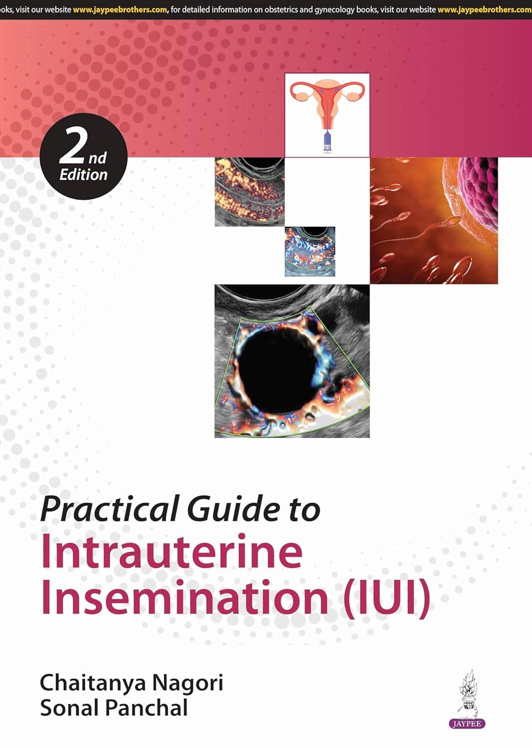 PRACTICAL GUIDE TO INTRAUTERINE INSEMINATION (IUI) 2ND/2025 - CHAITANYA NAGORI