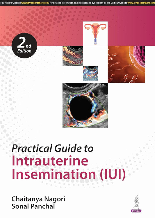 PRACTICAL GUIDE TO INTRAUTERINE INSEMINATION (IUI) 2ND/2025 - CHAITANYA NAGORI