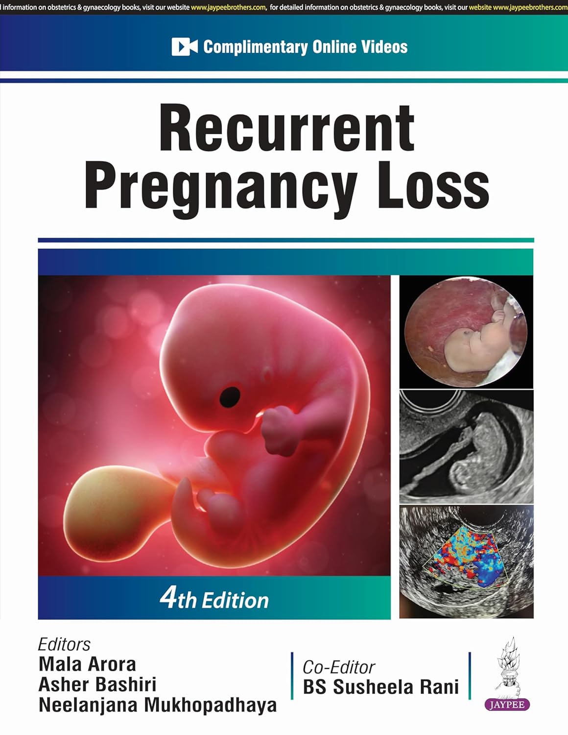 RECURRENT PREGNANCY LOSS 4TH/2025 - MALA ARORA