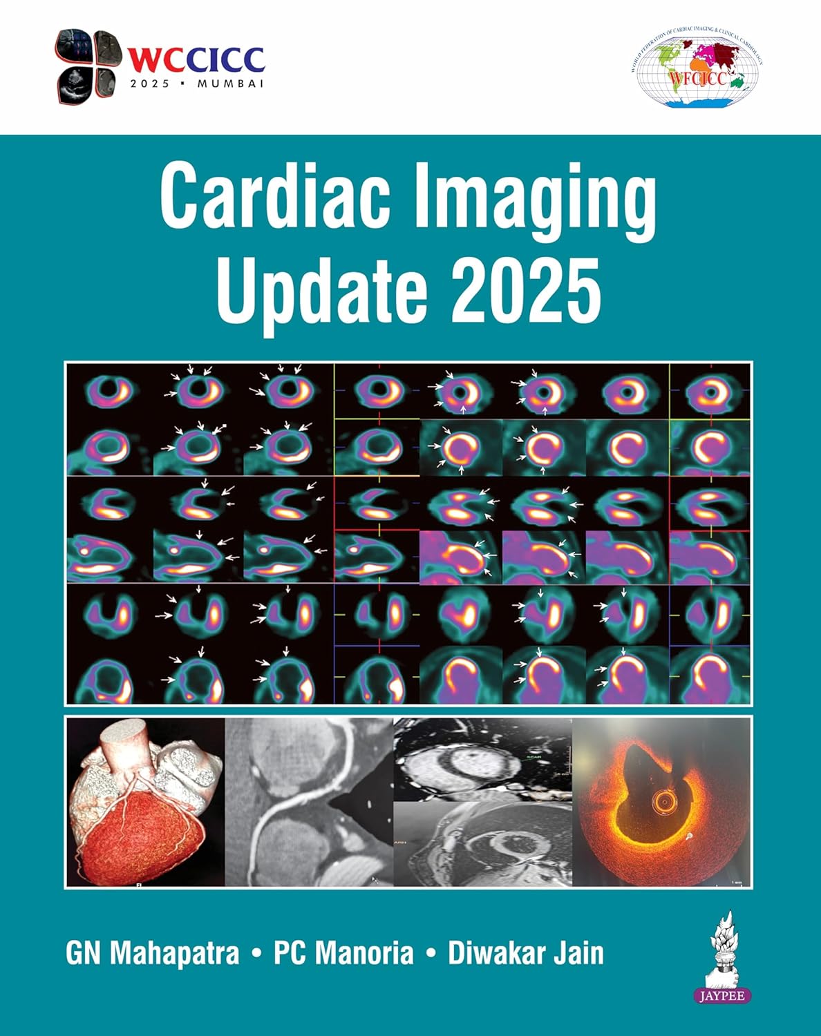 CARDIAC IMAGING UPDATE 2025 1ST/2026 - GN MAHAPATRA