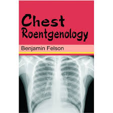 Chest Roentgenology 1st/2011