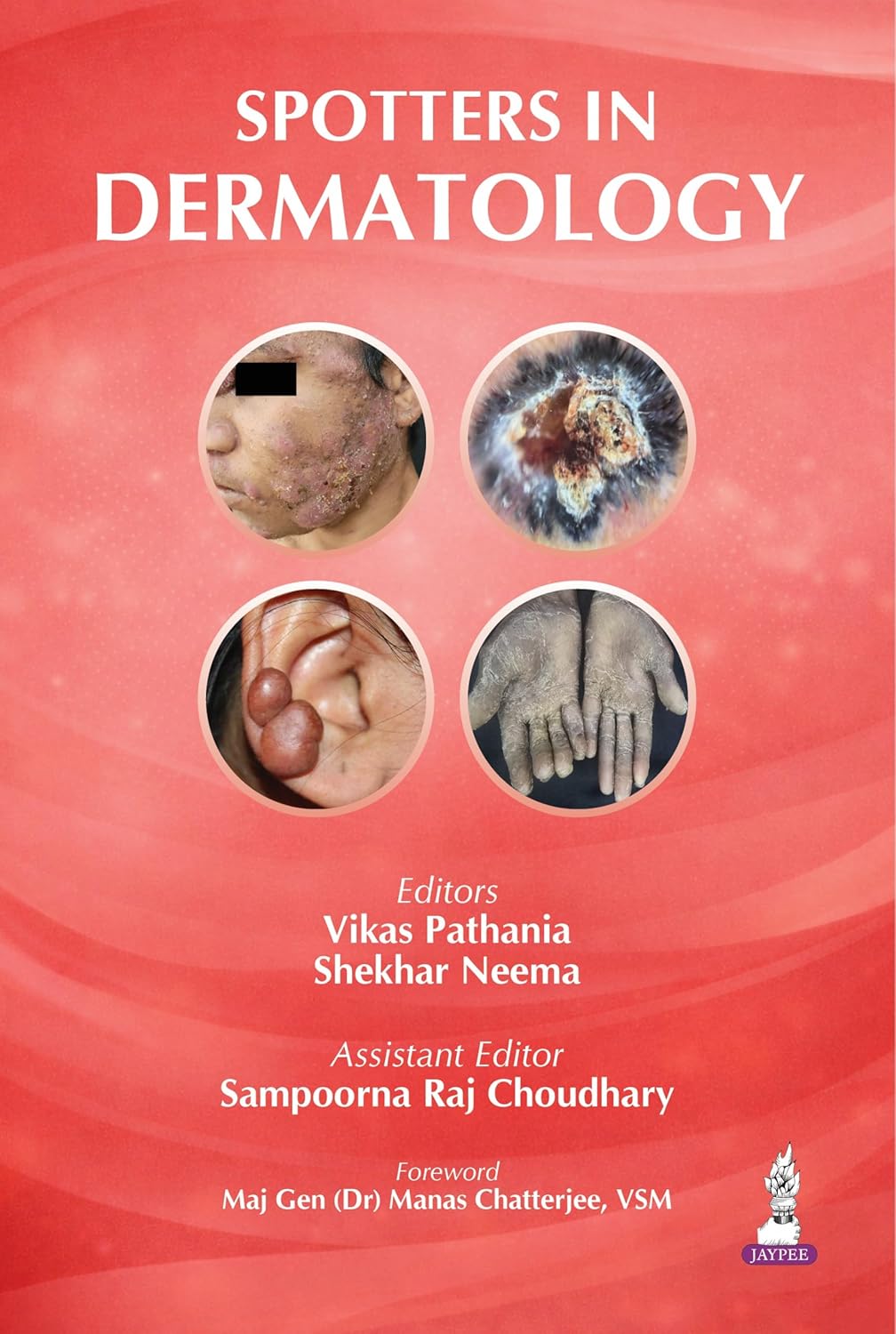 SPOTTERS IN DERMATOLOGY 1ST/2026 - VIKAS PATHANIA