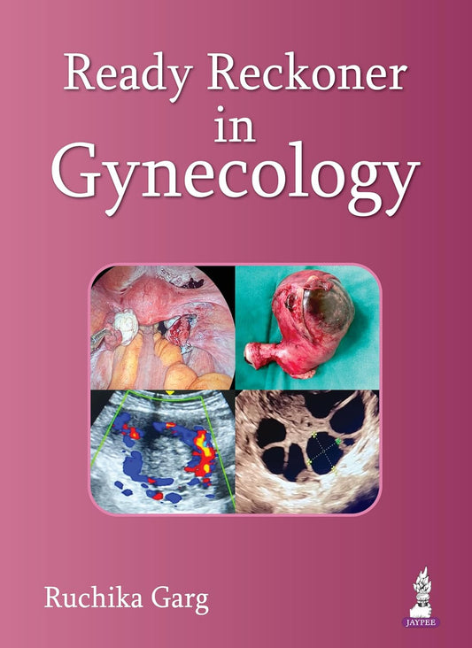 READY RECKONER IN GYNECOLOGY 1ST/2026 - RUCHIKA GARG