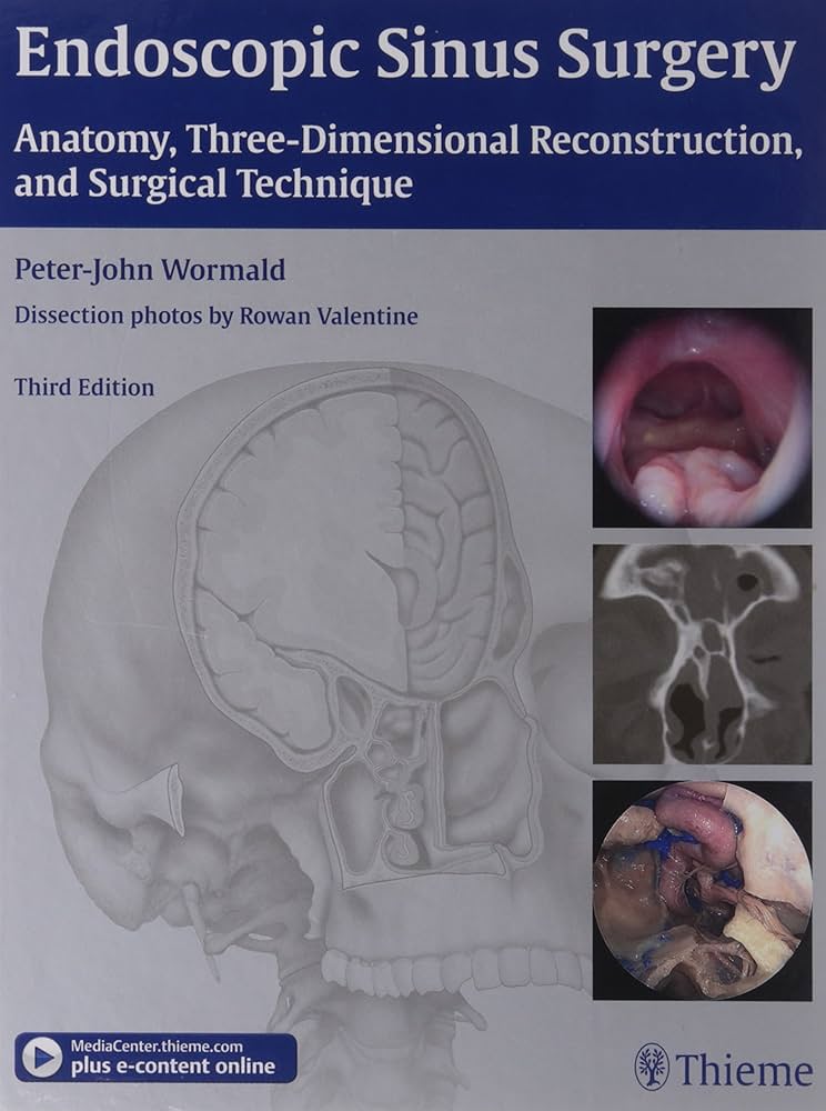 ENDOSCOPIC SINUS SURGERY ANATMOY THREE DIMENSIONAL RECONSTRUCTION AND SURGICAL TECHNIQUE 3E/2013