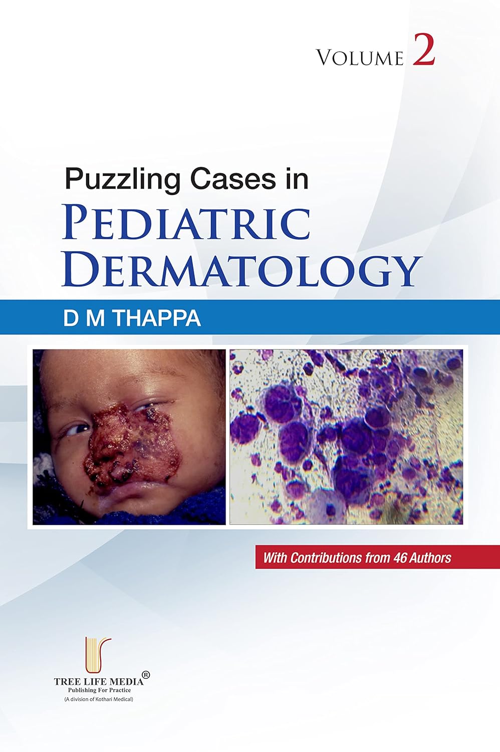 PUZZLING CASES IN PEDIATRIC DERMATOLOGY VOLUME-2 1ST/2022-DM THAPPA