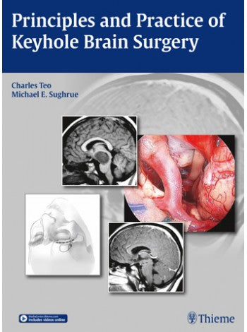 Principles and Practice of Keyhole Brain Surgery 1ST/2015