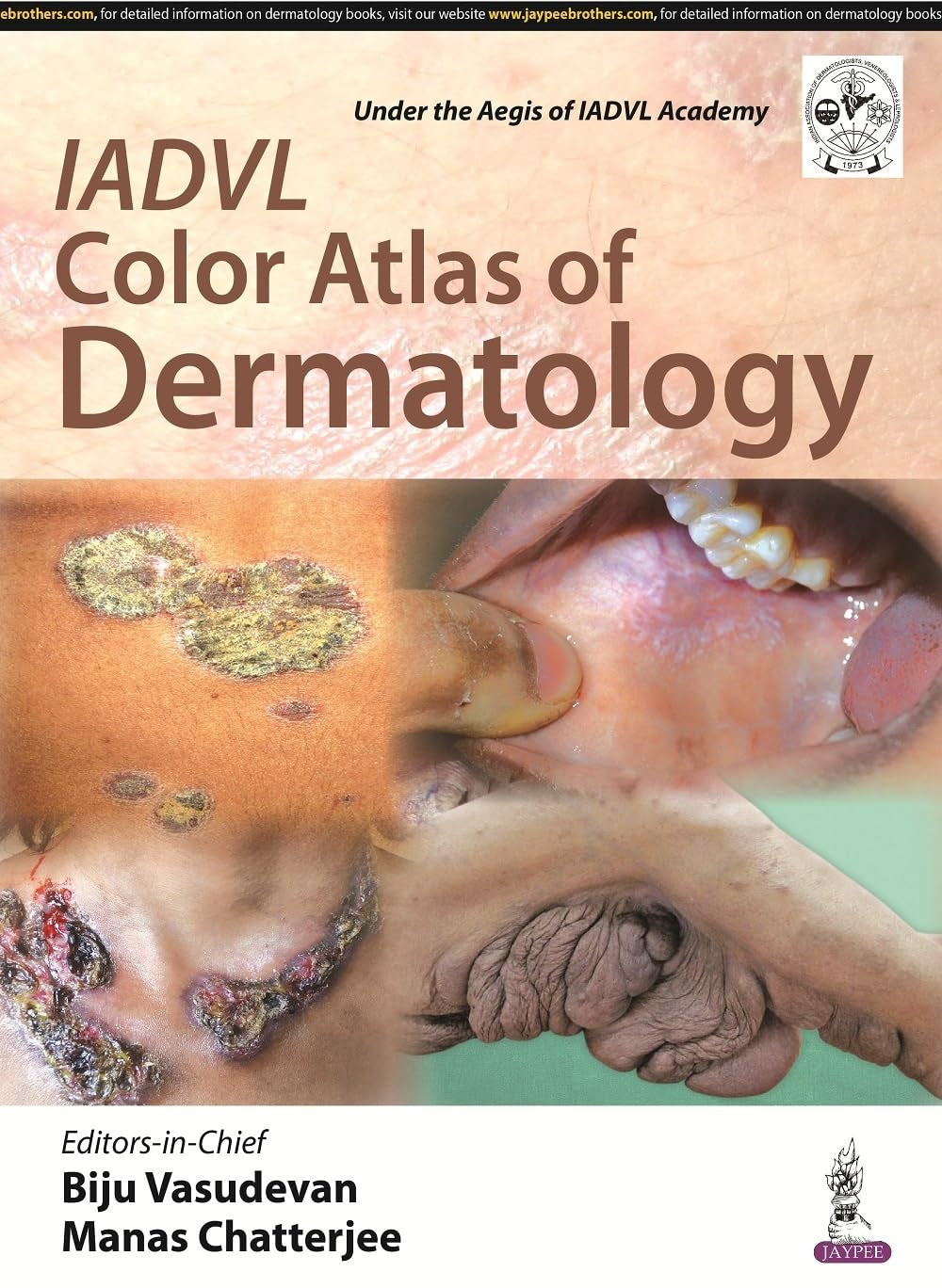IADVL COLOR ATLAS OF DERMATOLOGY 1ST/2016 - BIJU VASUDEVAN