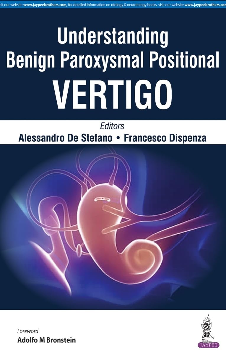 UNDERSTANDING BENIGN PAROXYSMAL POSITIONAL VERTIGO 1ST/2017 - ALESSANDRO DE STEFANO