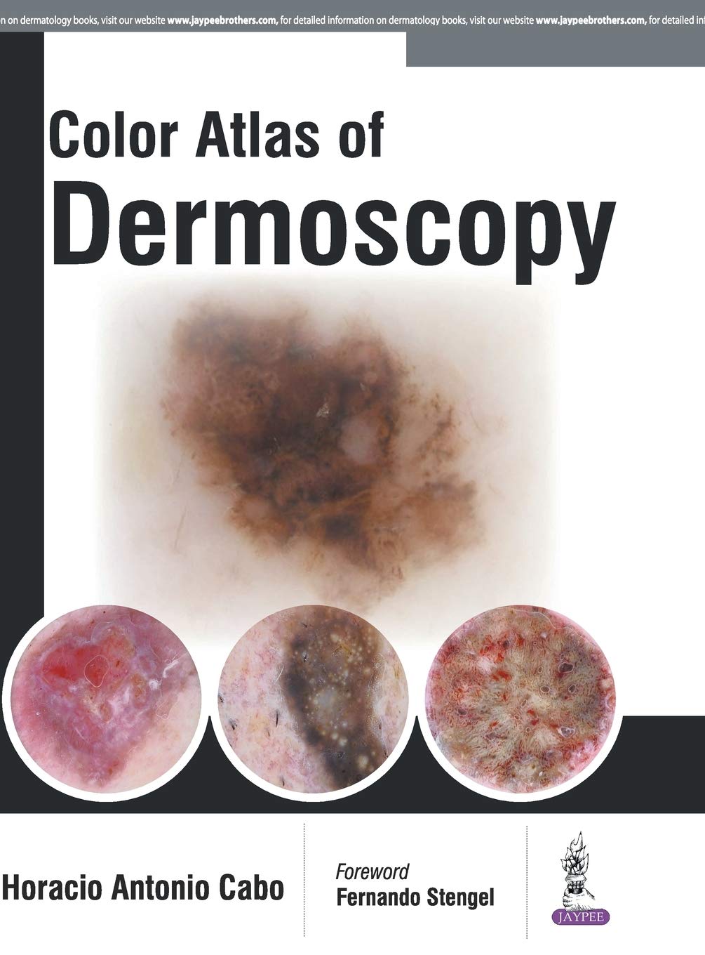 COLOR ATLAS OF DERMOSCOPY 1ST/2017 - HORACIO ANTONIO CABO