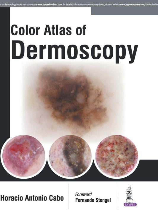 COLOR ATLAS OF DERMOSCOPY 1ST/2017 - HORACIO ANTONIO CABO