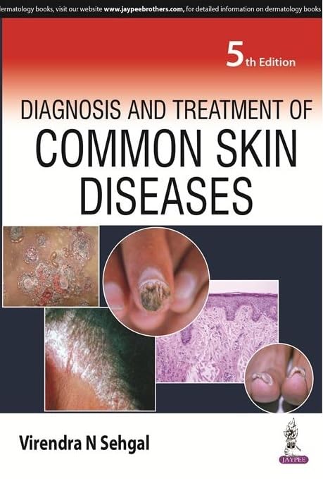 DIAGNOSIS AND TREATMENT OF COMMON SKIN DISEASES 5TH/2026 - VIRENDRA N SEHGAL