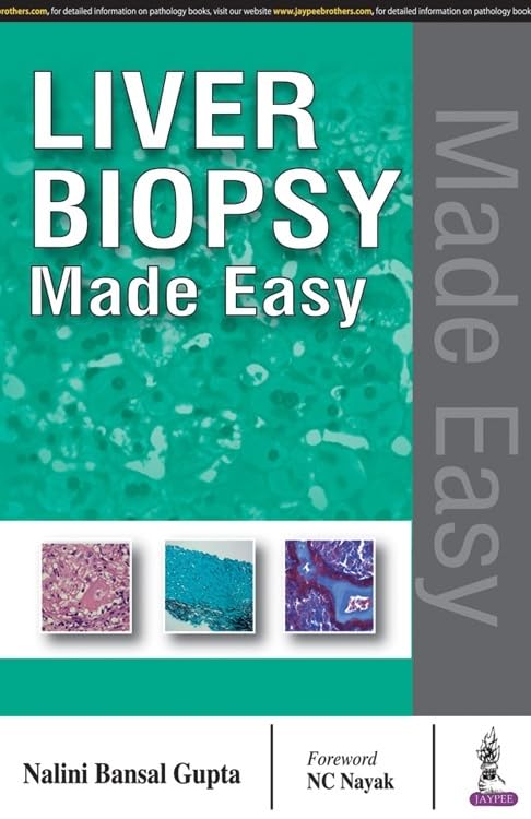 LIVER BIOPSY MADE EASY 1ST/2017 - NALINI BANSAL GUPTA
