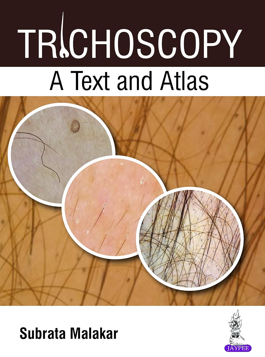 TRICHOSCOPY A TEXT AND ATLAS 1ST/2017 - SUBRATA MALAKAR