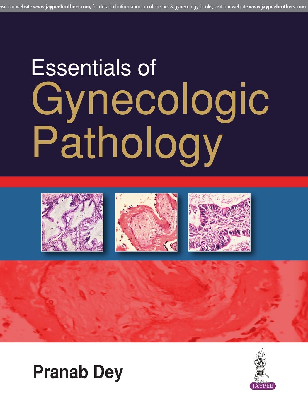ESSENTIALS OF GYNECOLOGIC PATHOLOGY 1ST/2017 - PRANAB DEY