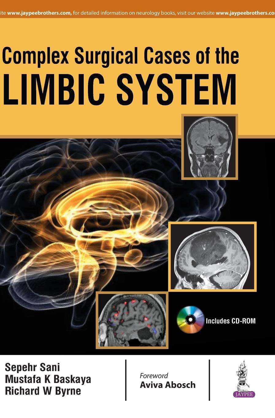 COMPLEX SURGICAL CASES OF THE LIMBIC SYSTEM 1ST/2017 - SEPEHR SANI