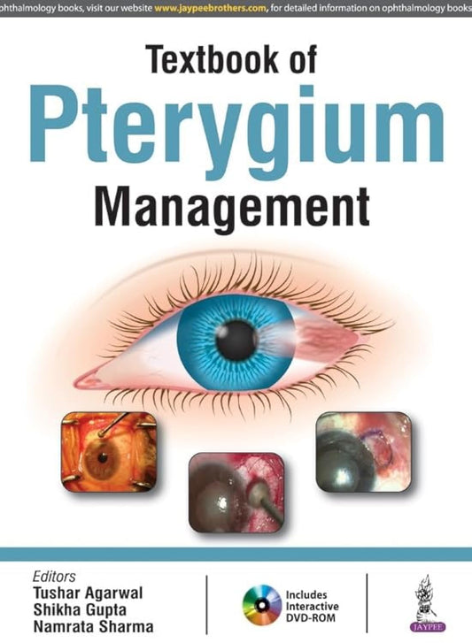 TEXTBOOK OF PTERYGIUM MANAGEMENT WITH DVD-ROM 1ST/2017 - TUSHAR AGARWAL