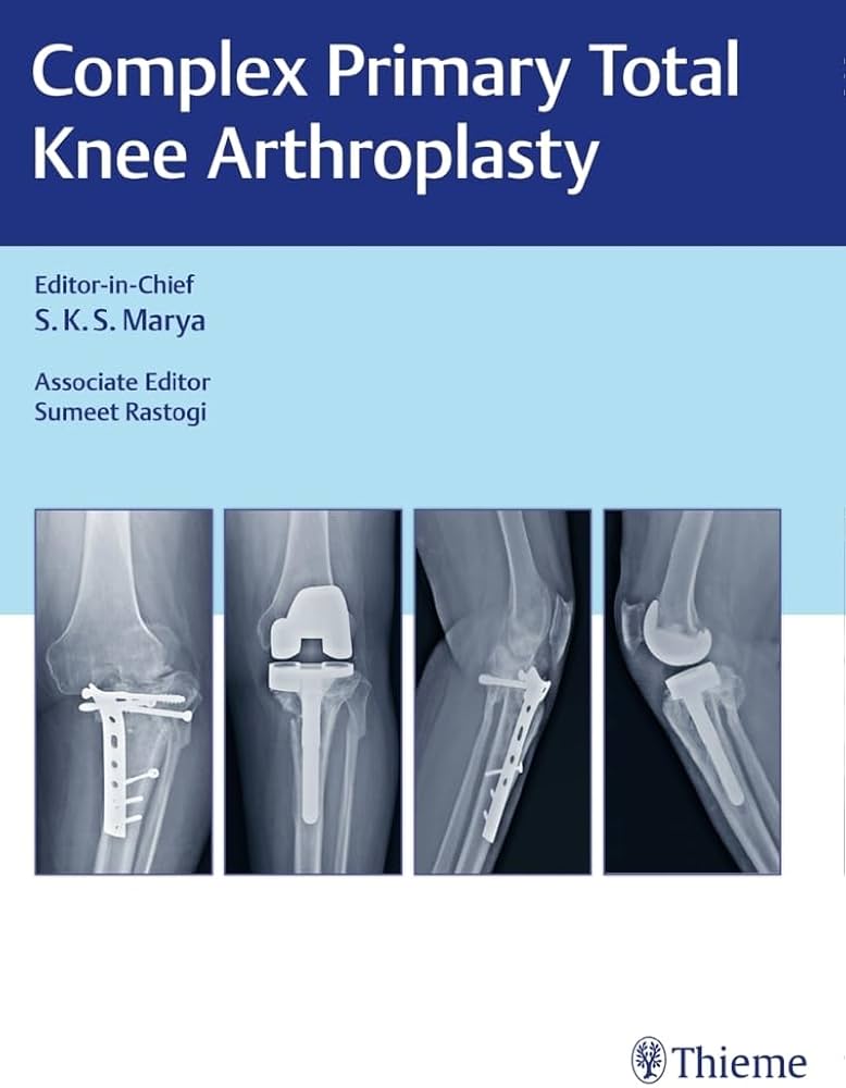 COMPLEX PRIMARY TOTAL KNEE ARTHROPLASTY 1ST/2017 - SKS MARYA