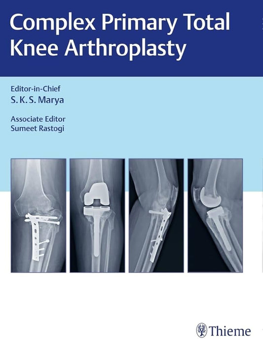 COMPLEX PRIMARY TOTAL KNEE ARTHROPLASTY 1ST/2017 - SKS MARYA
