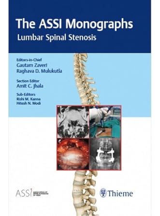 THE ASSI MONOGRAPHS LUMBAR SPINAL STENOSIS 1ST/2018 - GAUTAM ZAVERI
