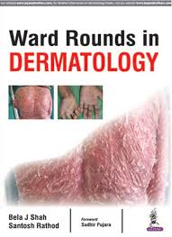 Ward Rounds In Dermatology1ST/2018