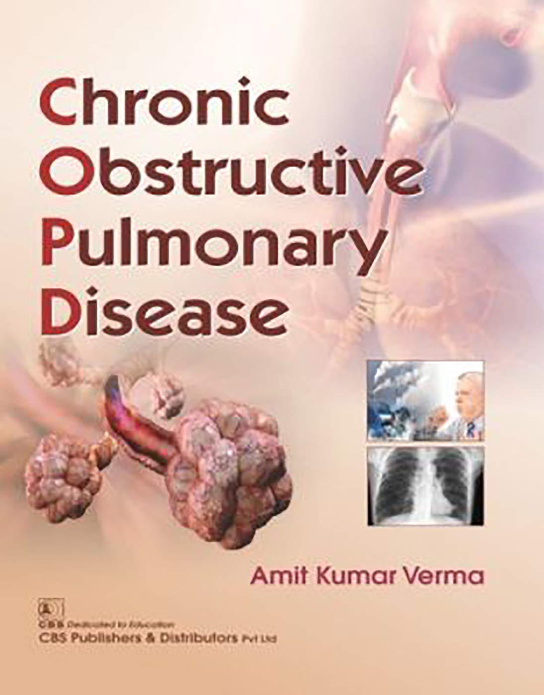 CHRONIC OBSTRUCTIVE PULMONARY DISEASE 1ST/2019-AMIT KUMAR VERMA
