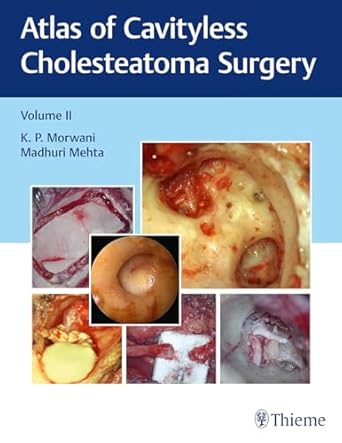 ATLAS OF CAVITYLESS CHOLESTEATOMA SURGERY VOLUME 2 1E/2019