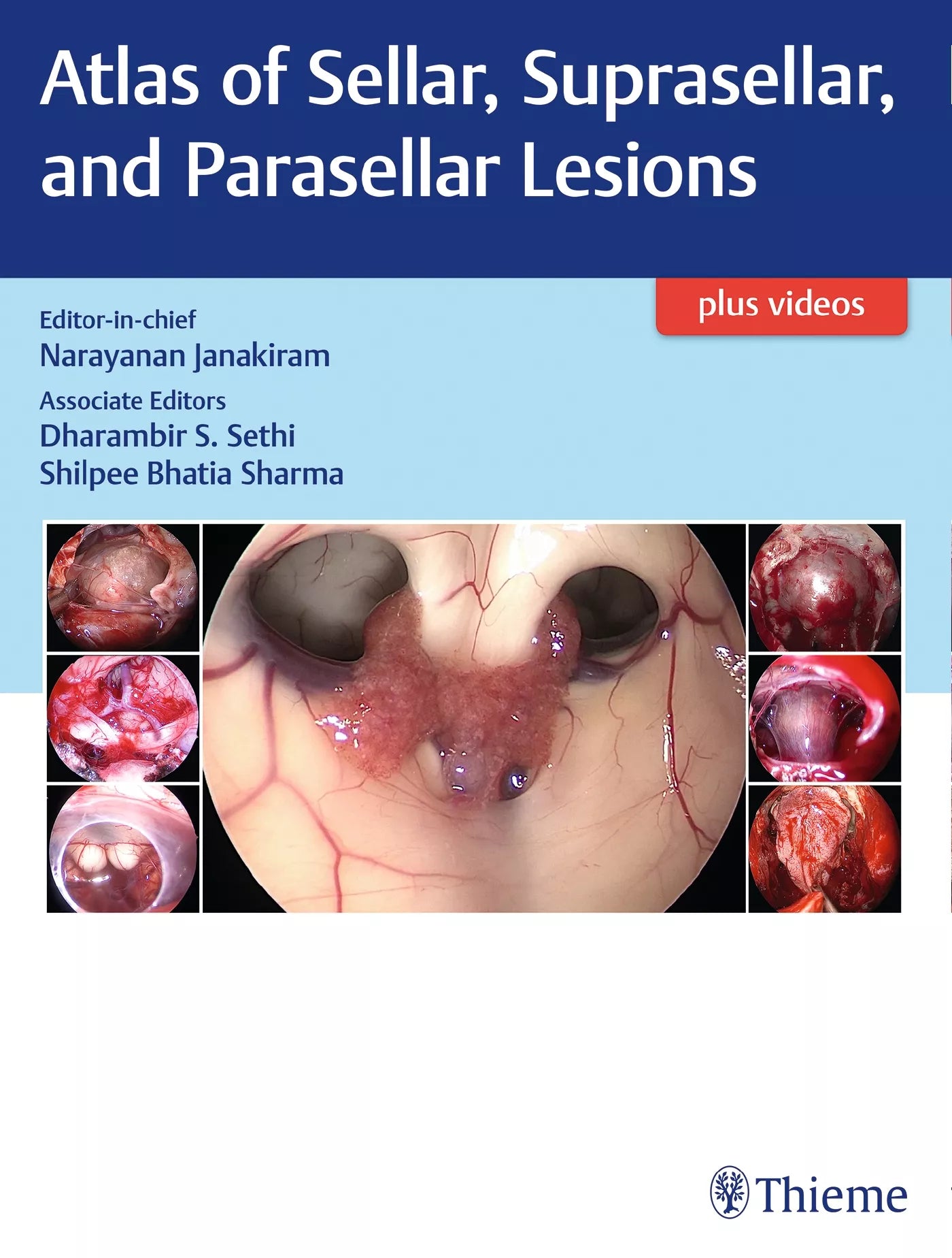 Atlas of Sellar, Suprasellar and Parasellar Lesions 1ST/2019