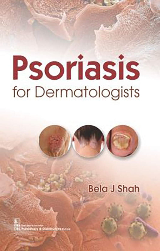 PSORIASIS FOR DERMATOLOGIST 1ST/2020 - BELA SHAH