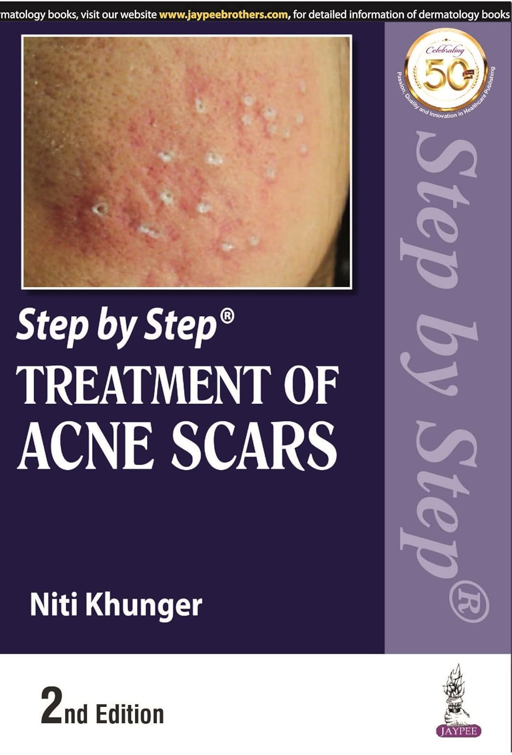 STEP BY STEP TREATMENT OF ACNE SCARS 2ND/2022 - NITI KHUNGER