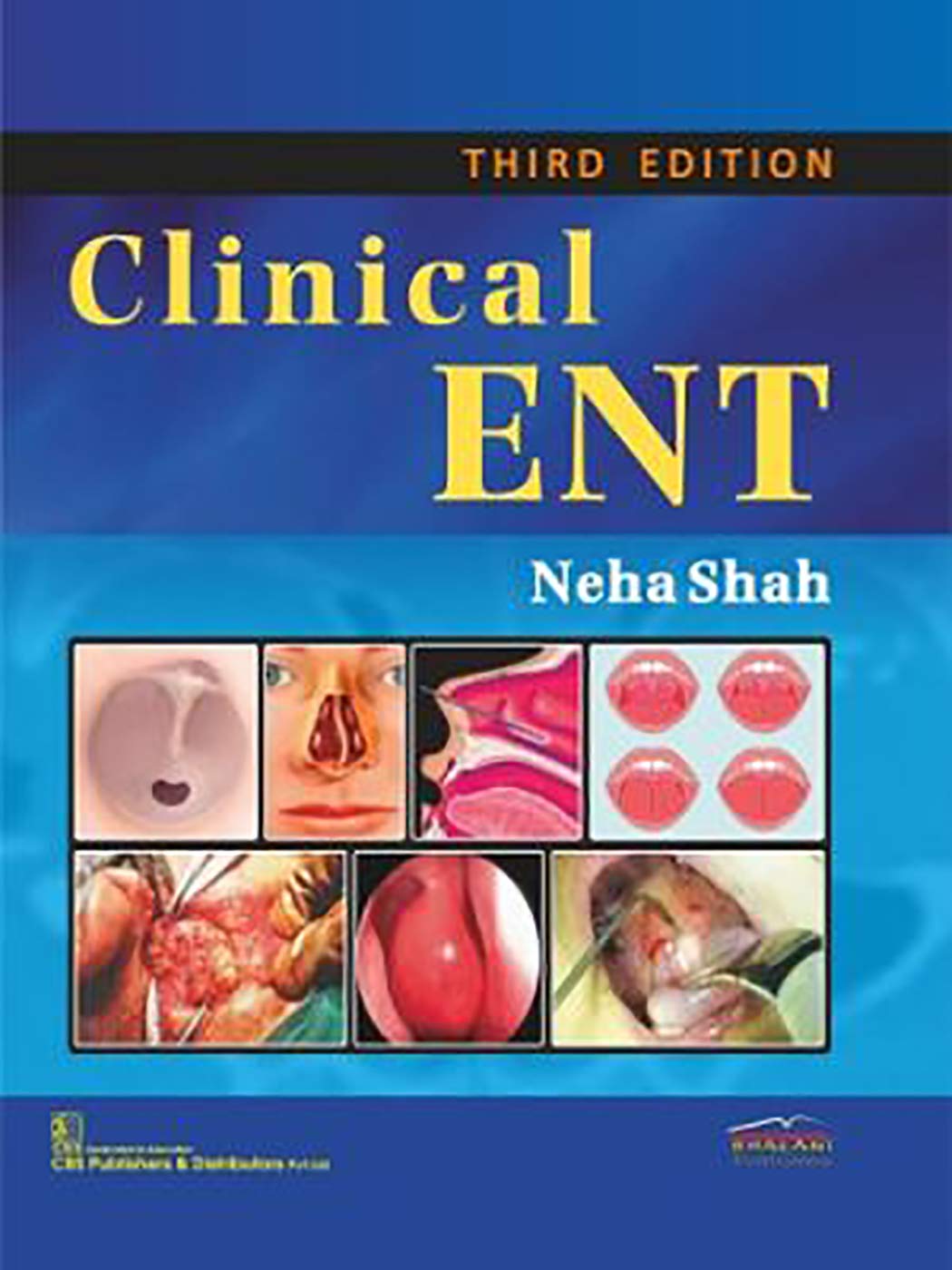 CLINICAL ENT 3RD/2025 - NEHA SHAH