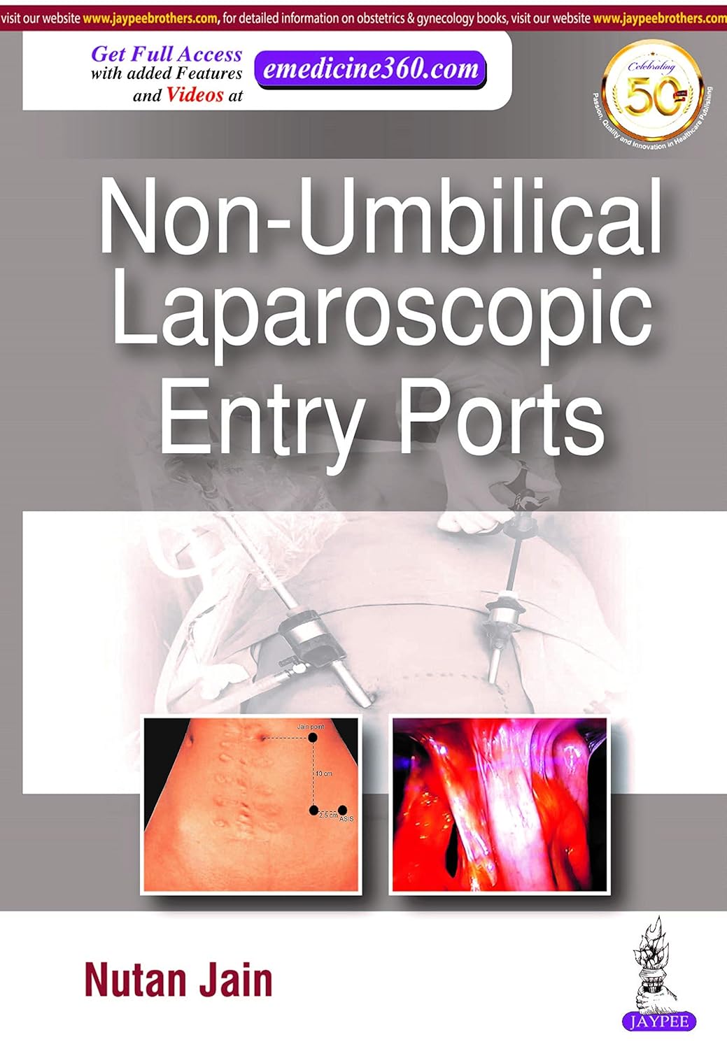 NON-UMBILICAL LAPAROSCOPIC ENTRY PORTS 1ST/2020 - NUTAN JAIN
