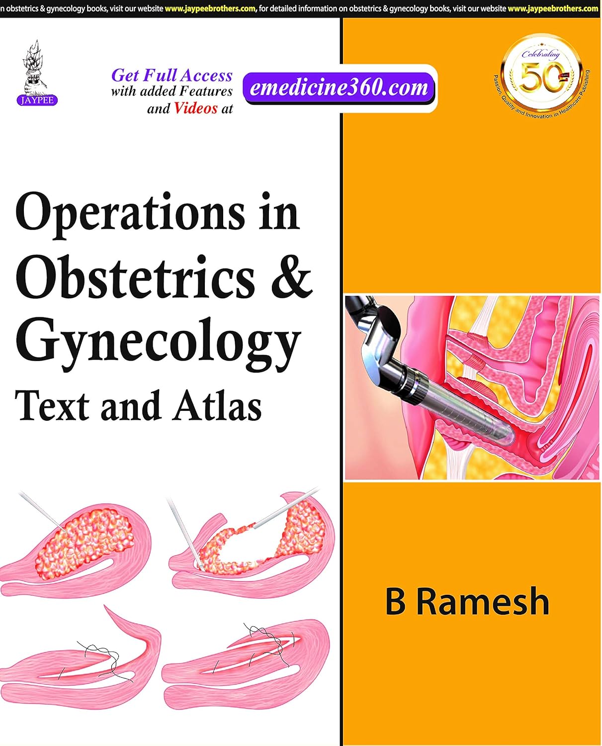 OPERATIONS IN OBSTETRICS & GYNECOLOGY: TEXT AND ATLAS 1ST/2020 - B RAMESH