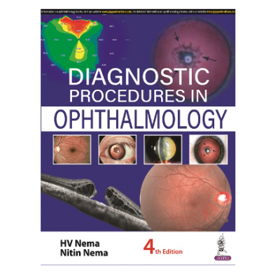 Diagnostic Procedures in Ophthalmology 4th/2022