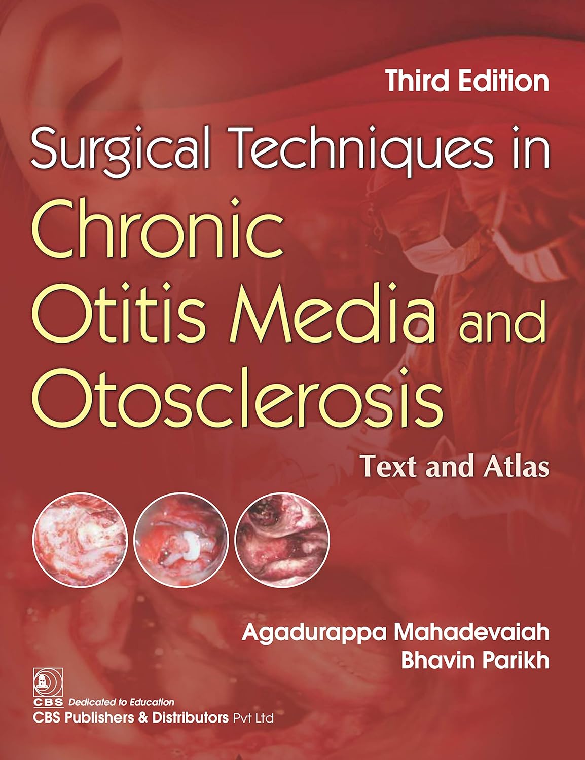 SURGICAL TECHNIQUES IN CHRONIC OTITIS MEDIA AND OTOSCLEROSIS 3RD/2023 - AGADURAPPA MAHADEVAIAH