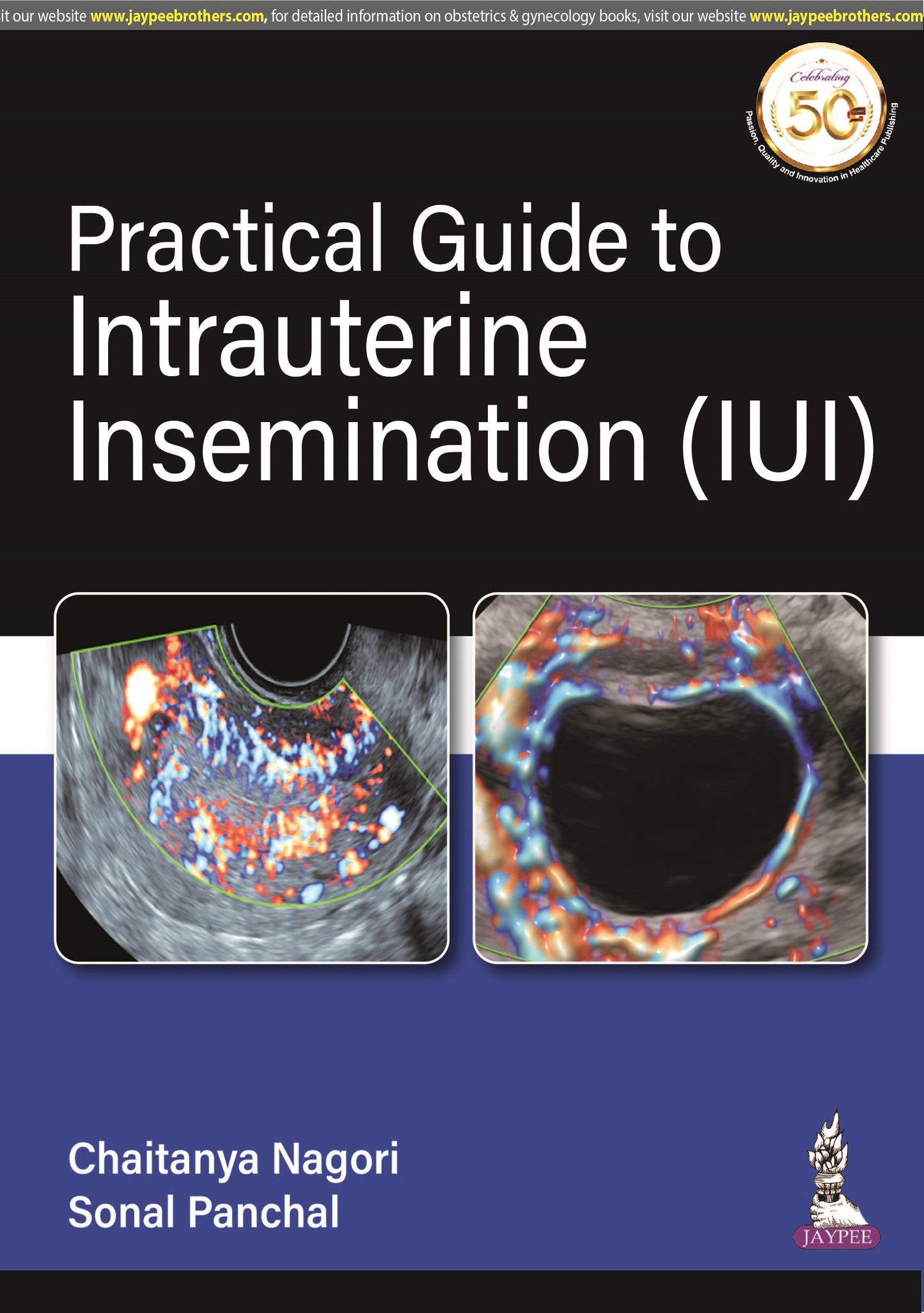 Practical Guide to Intrauterine Insemination (IUI)