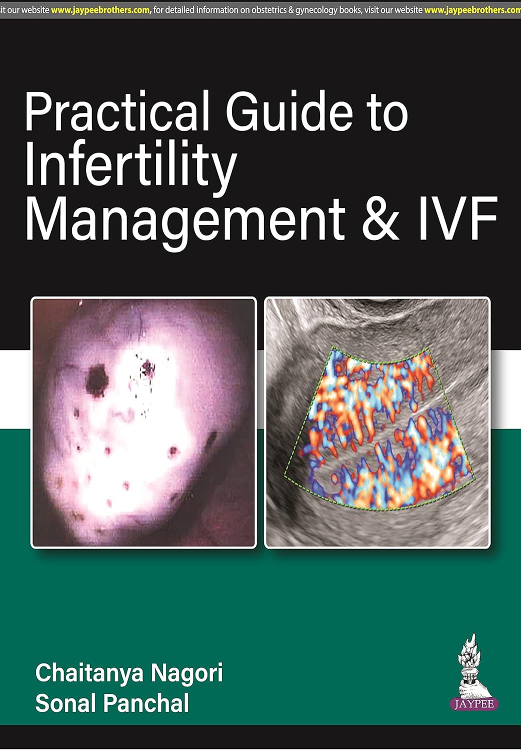 PRACTICAL GUIDE TO INFERTILITY MANAGEMENT & IVF 1ST/2023 - CHAITANYA NAGORI