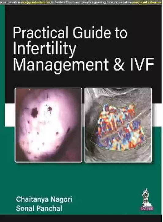 Practical Guide to Infertility Management & IVF 1st/2022