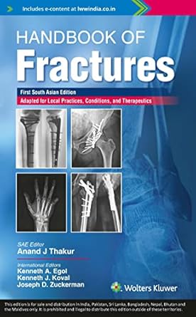 Handbook of Fractures 1st SAE/2022