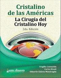 CRISTALINO DE LAS AMERICAS LA CIREGIA DEL CRISTALINO HOY 2ND/2016 - VIRGILIO CENTURION