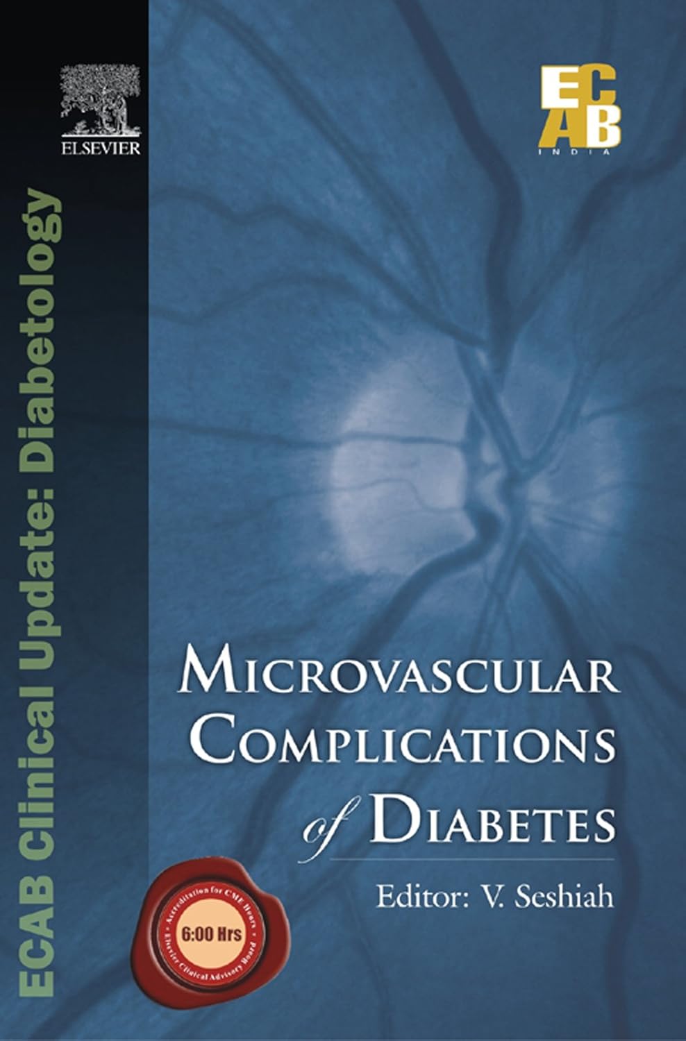 MICROVASCULAR COMPLICATION OF DIABETES 1ST/2009 - V SESHIAH
