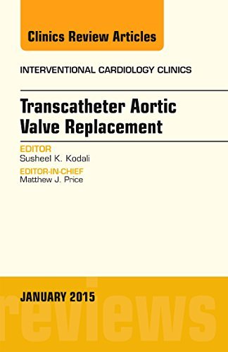 TRANSCATHETER AORTIC VALVE REPLACEMENT : INTERVENTIONAL CARDIOLOGY CLINICS VOL 4 - SUSHEEL KODALI