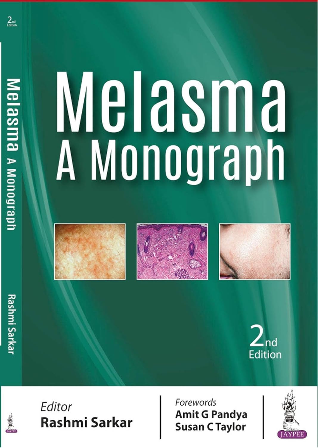 MELASMA A MONOGRAPH 2ND/2018 - RASHMI SARKAR