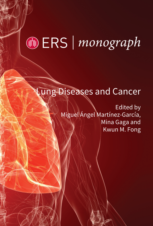 ERS MONOGRAH LUNG DISEASES AND CANCER 1E/2021