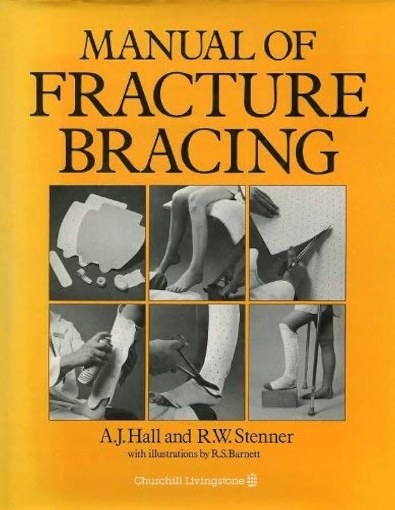 MANUAL OF FRACTURE BRACING 1E/1985