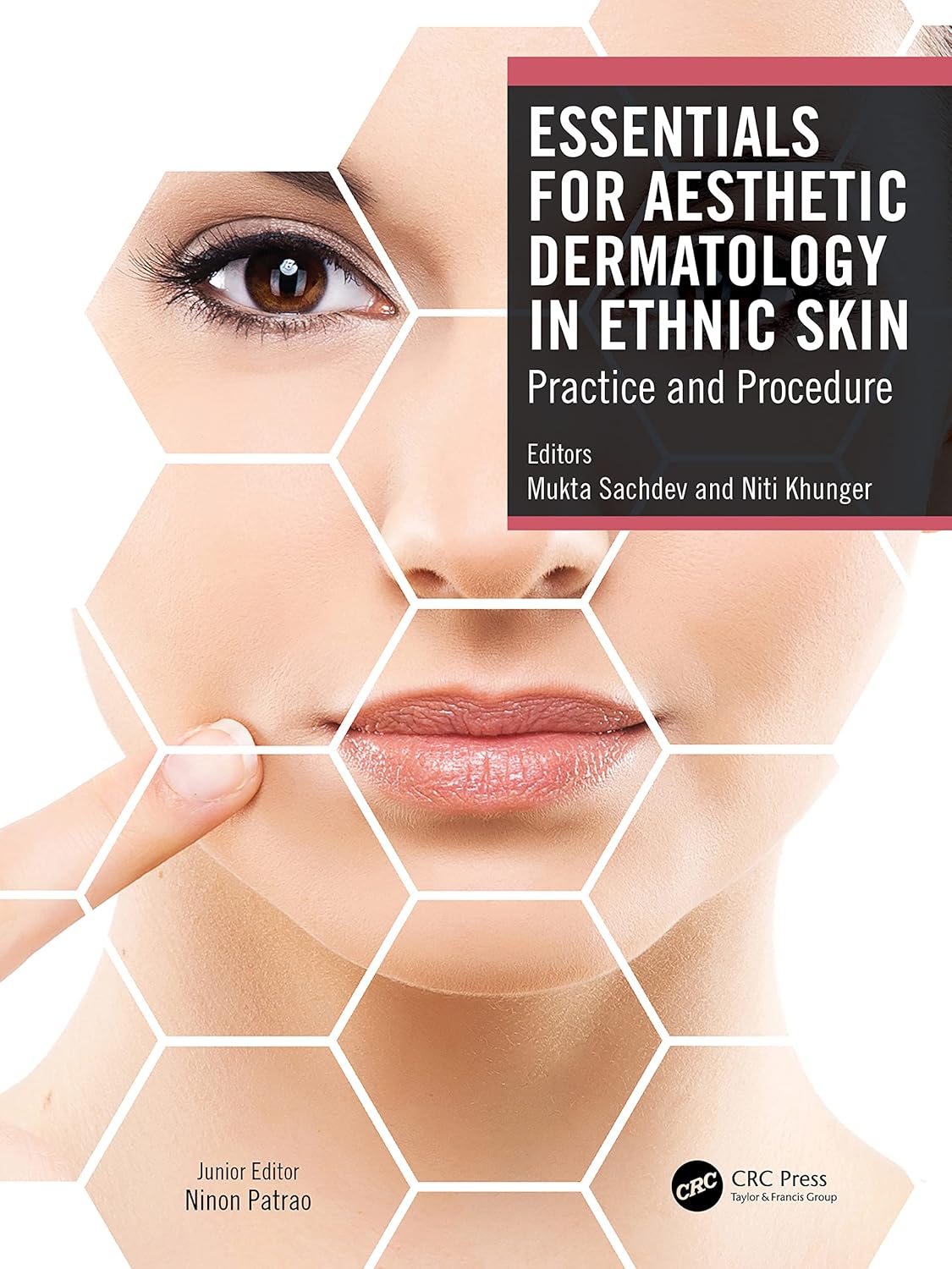 ESSENTIALS FOR AESTHETIC DERMATOLOGY IN ETHNIC SKIN 1ST/2023 - MUKTA SACHDEV