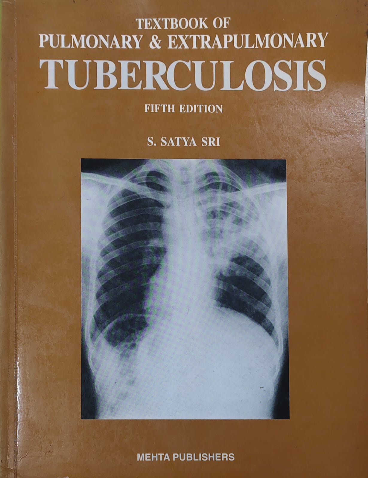 TEXTBOOK OF PULMONARY AND EXTRAPULMONARY TUBERCULOSIS 5TH/2003 - SATYA SRI