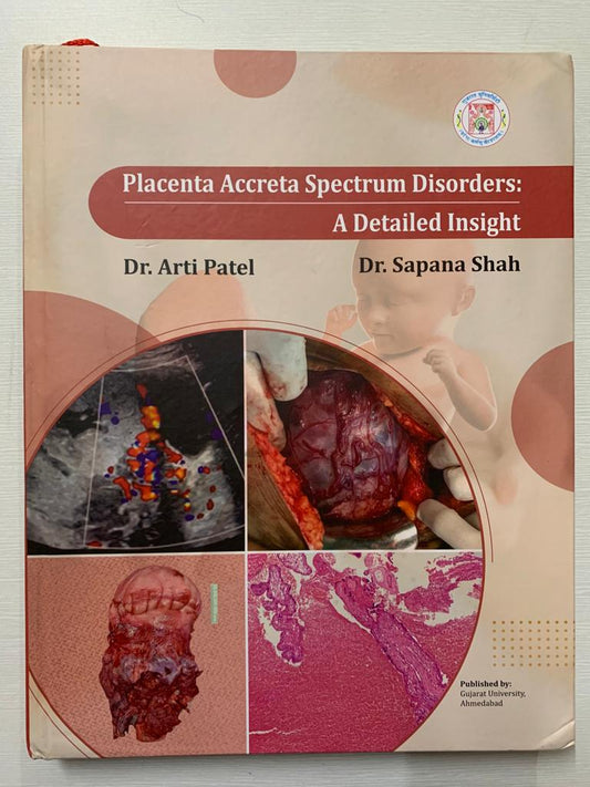 PLACENTA ACCRETA SPECTRUM DISORDER: A DETAILED INSIGHT 1ST/2025 - SAPANA SHAH, RUPAL SHAH