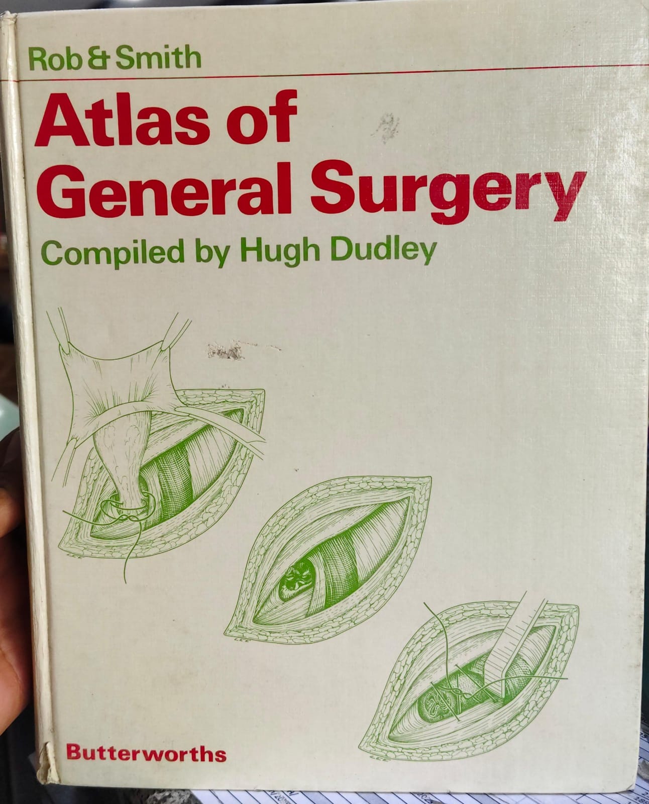 ROB AND SMITH ATLAS OF GENERAL SURGERY  COMPILED BY HUGH DUDLEY 1ST/1983