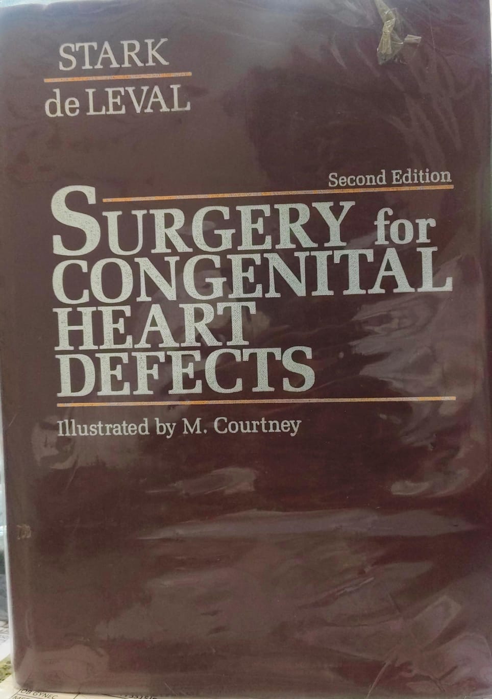 SURGERY FOR CONGENITAL HEART DEFECTS 2E/1994