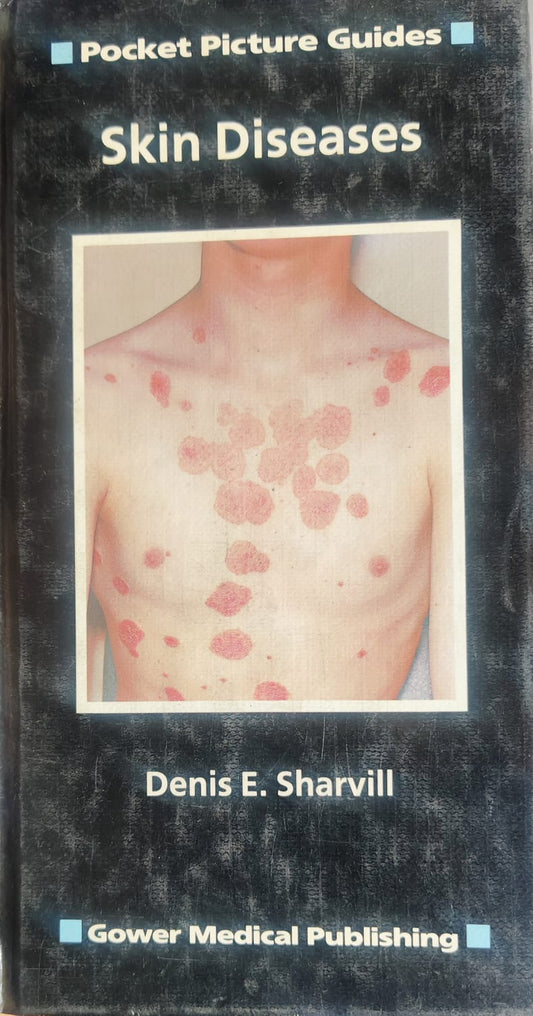 POCKET PICTURE GUIDES SKIN DISEASES 1st/1984 - DENIS SHERVIL